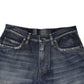 Blue Cotton Distressed Denim Bermuda Shorts